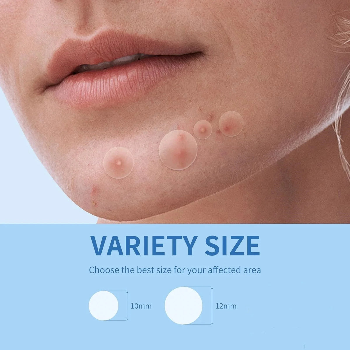 Close-up of a person's face with blemishes and a blue banner indicating 'Variety Size' with measurements.